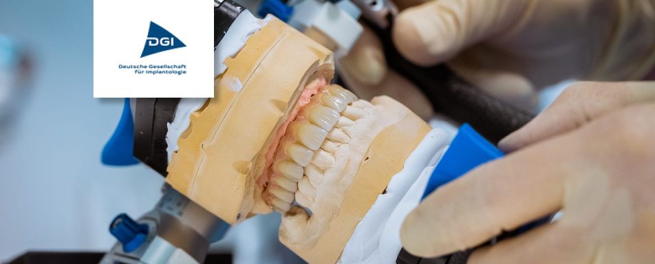 Eine Nahaufnahme zeigt ein Zahnlabor-Modell in der Supervisions- und Hospitationspraxis mit Fokus auf Implantologie.