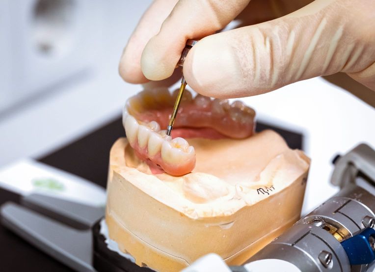 Ein Zahntechniker bearbeitet ein Zahnmodell präzise mit einem Werkzeug für den Dentalbereich.