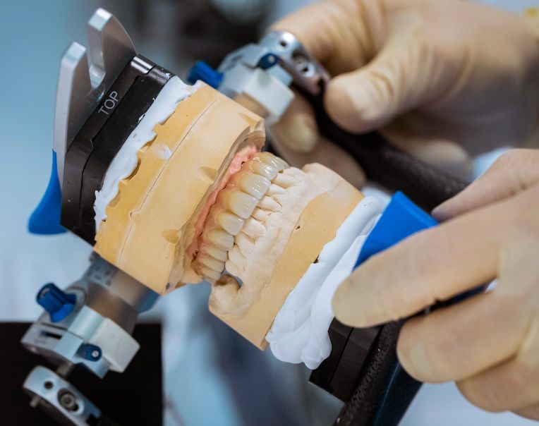 Hochwertiger Zahnersatz - Zahnimplantate Gummersbach